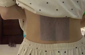 遠(yuǎn)紅外理療貼對腰椎間盤突出有用嗎